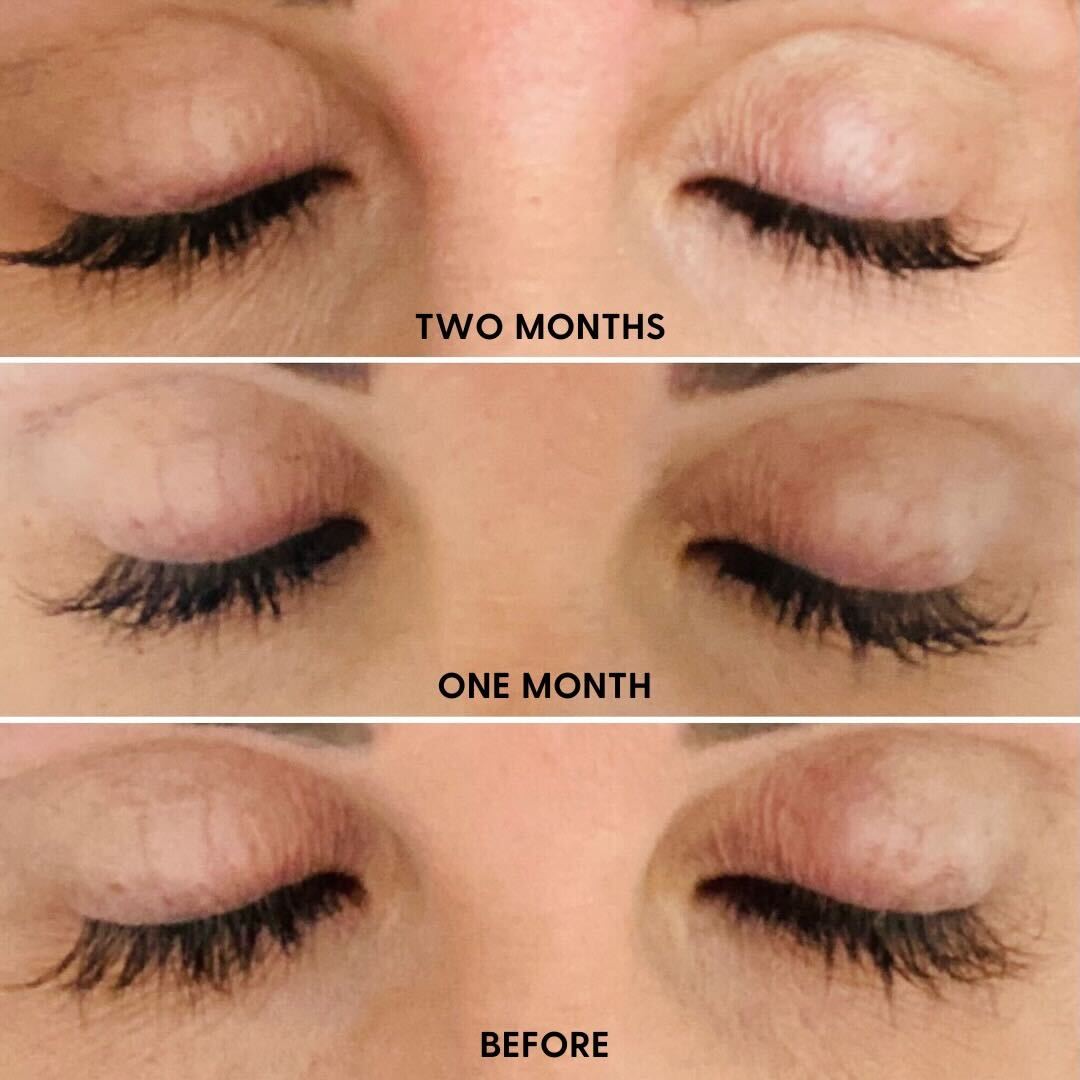 Full View Lash Serum-12 week supply